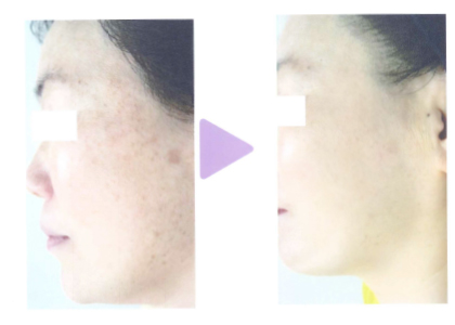 千葉県千葉市　エステサロン 「ベルフェム」